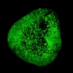 a-groundbreaking-brain-map-could-revolutionize-parkinsons-treatment