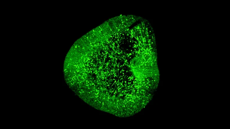 groundbreaking-human-brain-atlas-unveiled-by-duke-nus-scientists-paving-the-way-for-precision-therapies-in-parkinsons-disease